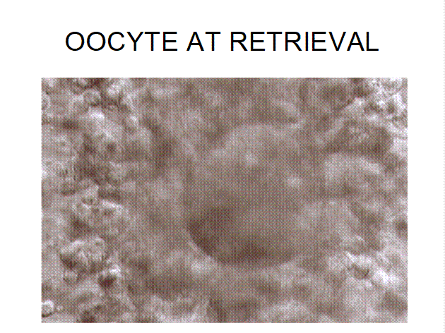 Extracted mature oocyte surrounded by cumulus cells under laboratory magnification
