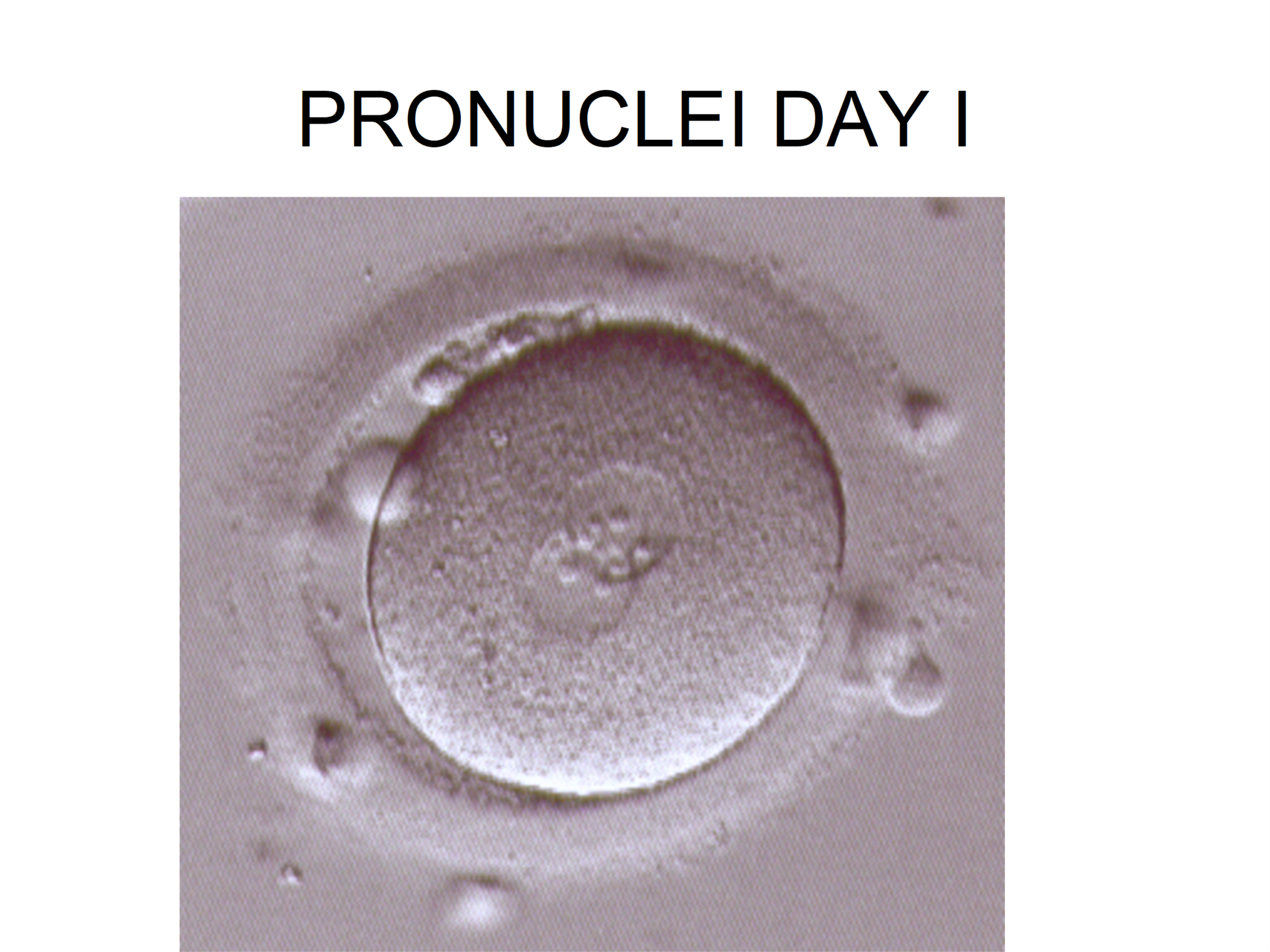 Fertilization Check (Day 1)